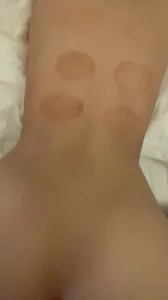 后入极品身材小母狗，刚拔完火罐没两天就被爆操